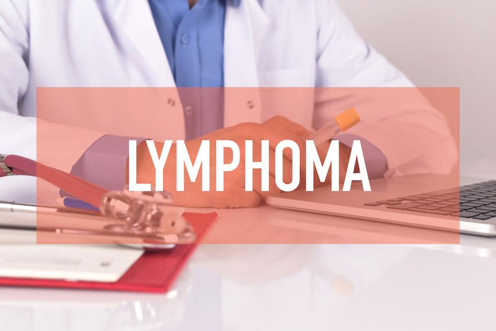 Non Hodgkin Lymphoma treatment – Symptoms, causes and more explained